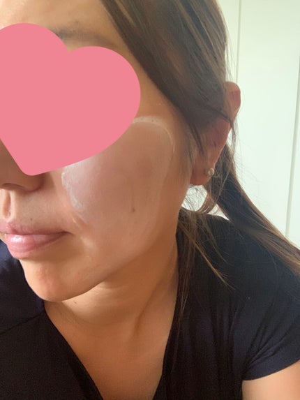 デュイセル ターンオンクリーム/DEWYCEL/フェイスクリームを使ったクチコミ(2枚目)