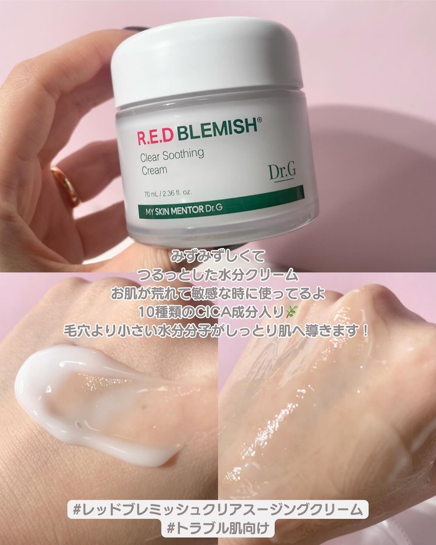 レッドブレミッシュ クリアスージングクリーム/Dr.G/フェイスクリームを使ったクチコミ(2枚目)
