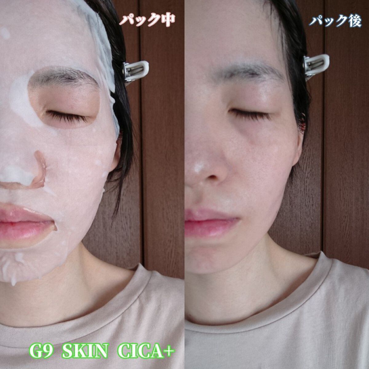 シカプラス ディープモイスチャーマスク/G9SKIN/シートマスク・パックを使ったクチコミ(3枚目)