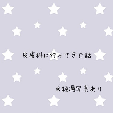 




\ ニキビ治療をはじめました /





下の子出産後からニキビに悩まされて
早1年半が経ちました。

はじめは産後でホルモンバランス崩れるし
寝れてないからかな〜なんて

軽く考えてました