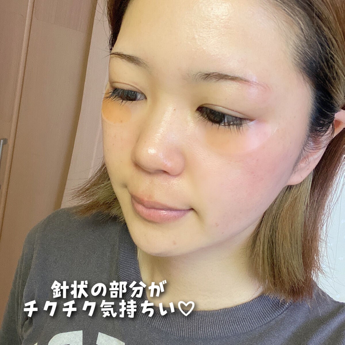 NDマイクロパッチ HA/NEEDROP/シートマスク・パックを使ったクチコミ(7枚目)