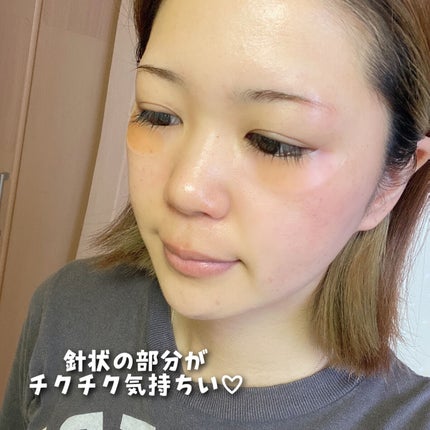 NDマイクロパッチ HA/NEEDROP/シートマスク・パックを使ったクチコミ(7枚目)