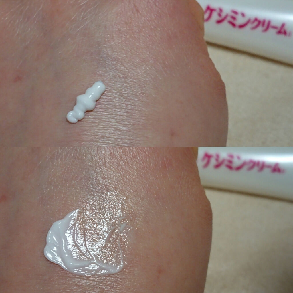 ケシミン クリームj/ケシミン/その他スキンケアを使ったクチコミ（3枚目）