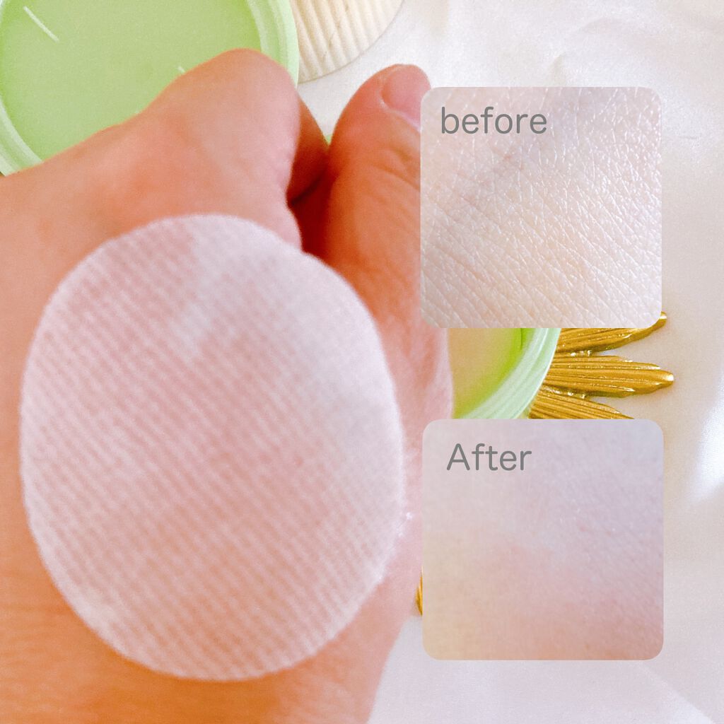 ドクダミカーミングタッチスポットパッド/Abib /トナーパッドを使ったクチコミ（3枚目）