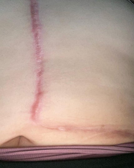 ヘパトリート 薬用保湿ミルククリーム/ゼトックスタイル/ボディクリームを使ったクチコミ(6枚目)