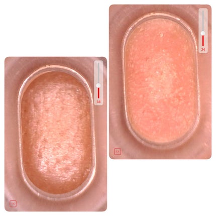 アレティ ポアスコープ/Areti./美顔器・マッサージを使ったクチコミ(8枚目)