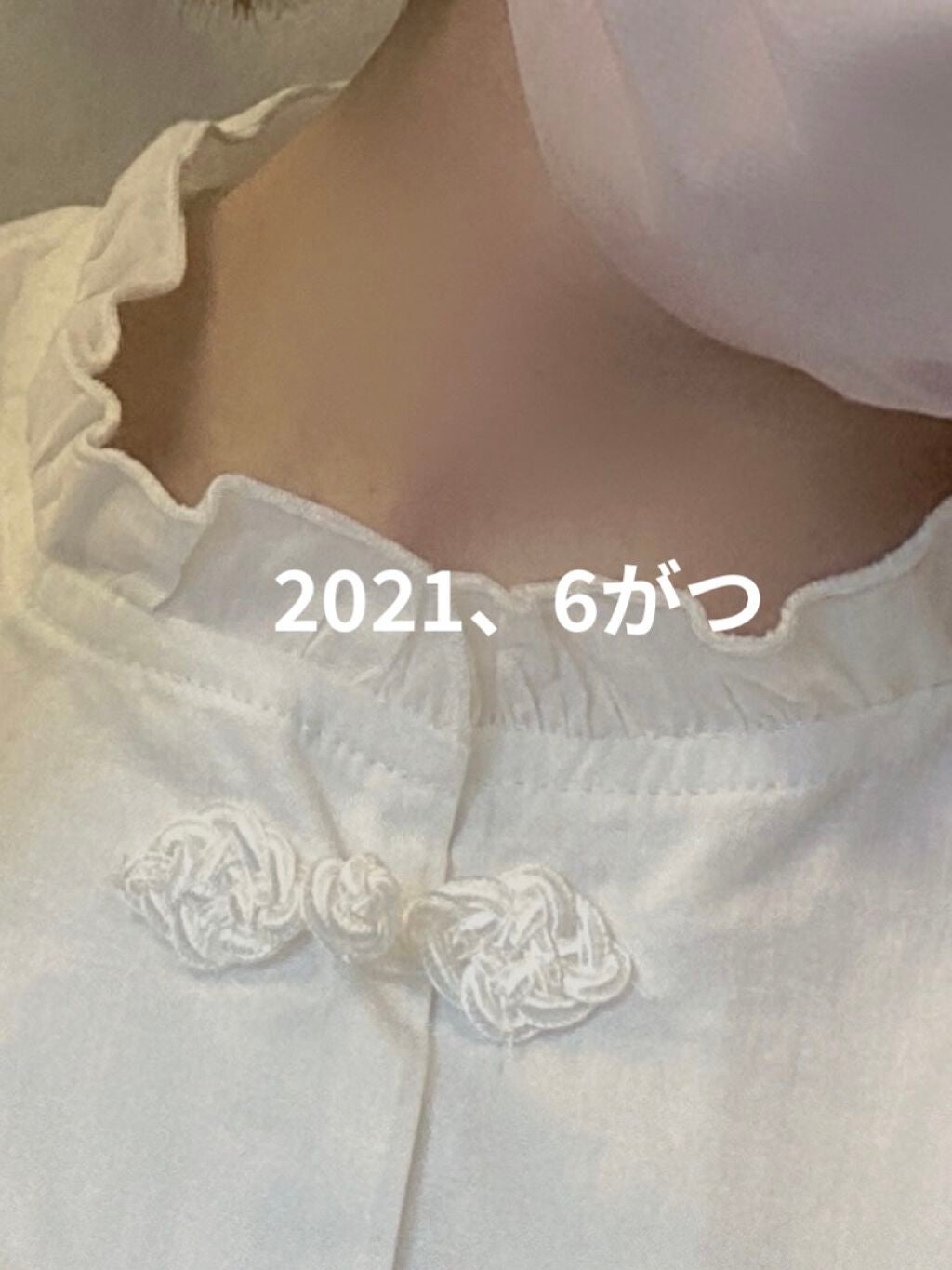 オードムーゲ 薬用ローション(ふきとり化粧水)/オードムーゲ/拭き取り化粧水を使ったクチコミ(5枚目)