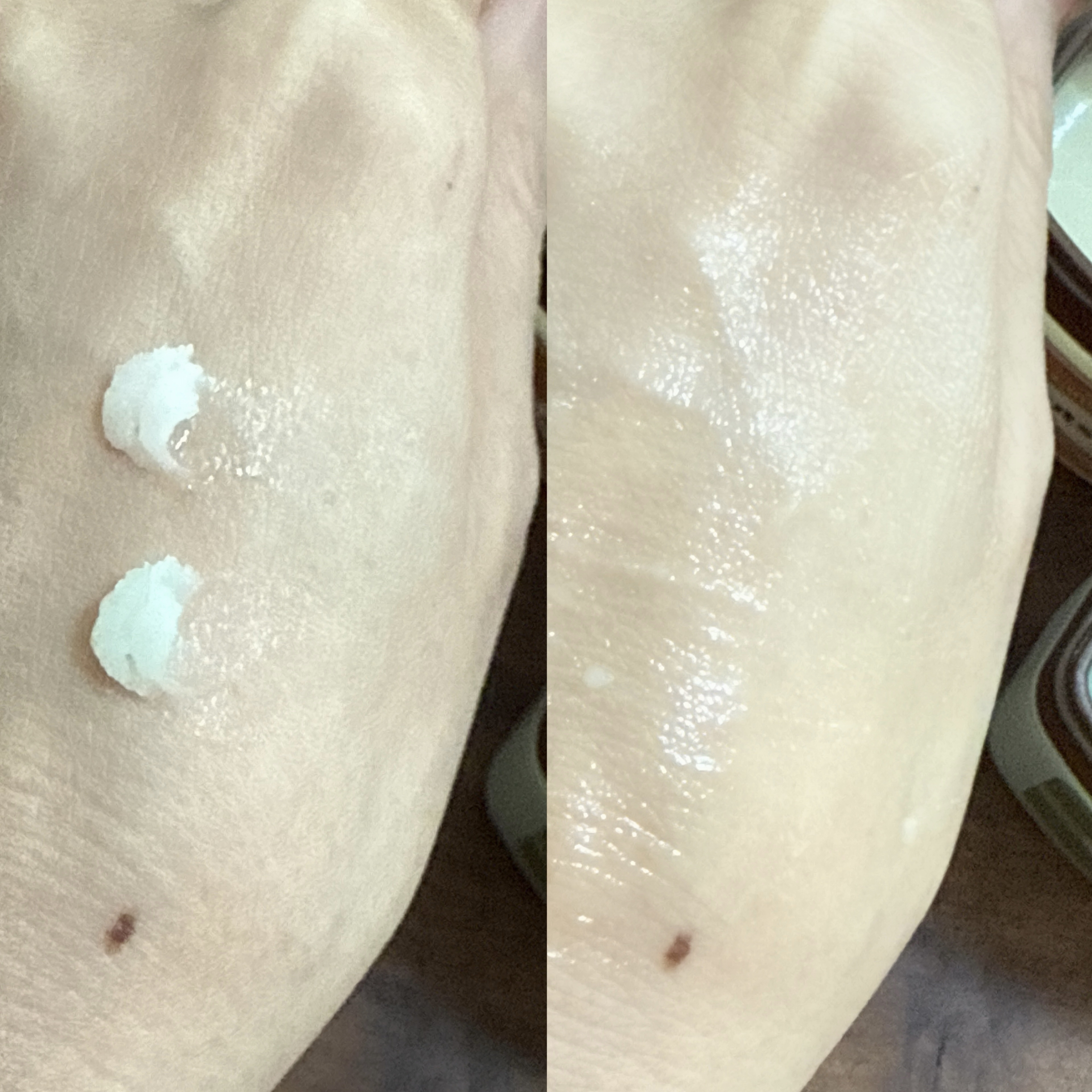 cica nut calming balm/ナッツセリン/フェイスバームを使ったクチコミ（2枚目）