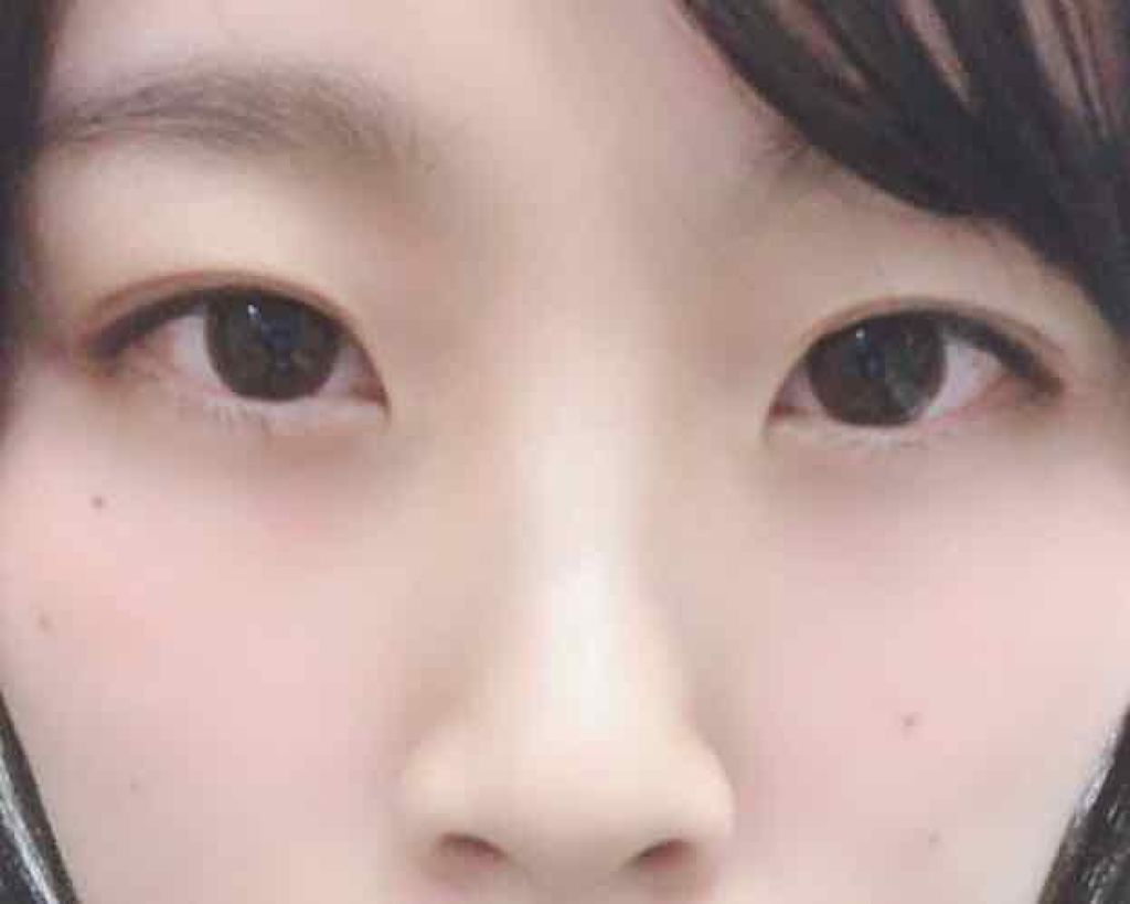 アイテープ片面(のびる)絆創膏タイプ スリム 120枚/セリア/二重まぶた用アイテムを使ったクチコミ(1枚目)