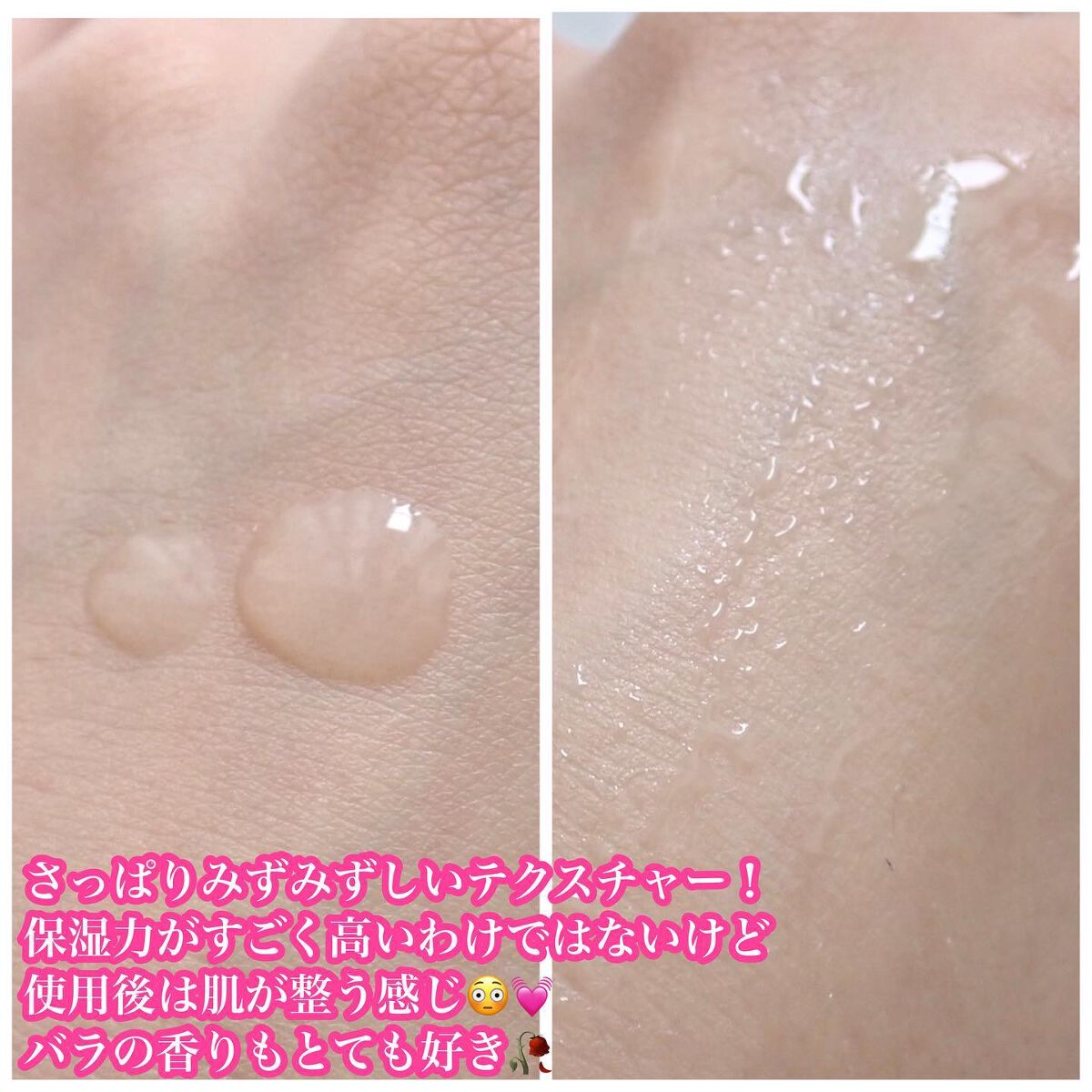 ブレミッシュケア トニックエッセンス/ISOI/化粧水を使ったクチコミ(3枚目)