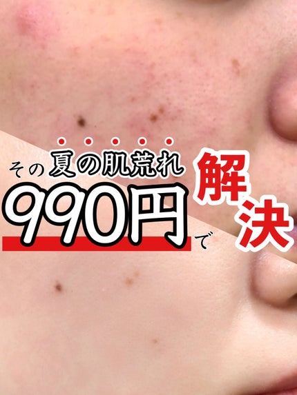 ハトムギ保湿ジェル(ナチュリエ スキンコンディショニングジェル)/ナチュリエ/美容液を使ったクチコミ(1枚目)