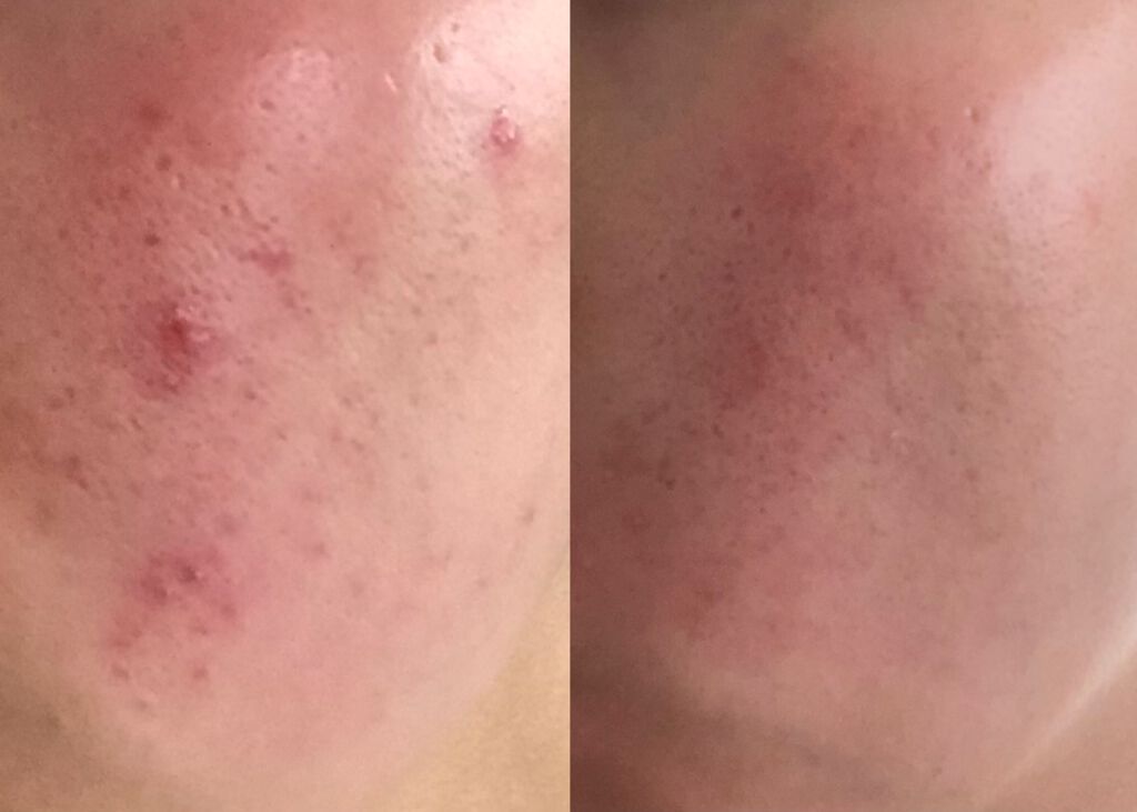 明色美顔水 薬用化粧水/美顔/化粧水を使ったクチコミ（2枚目）