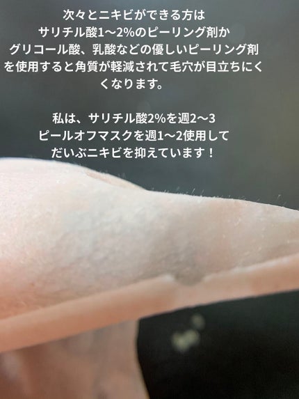 クリアリングピールオフクレイマスク スイートティー+レモン/Freeman Beauty/洗い流すパック・マスクを使ったクチコミ(6枚目)