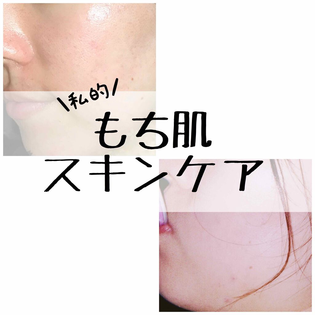 AC フェイスローション/NOV/化粧水を使ったクチコミ(1枚目)