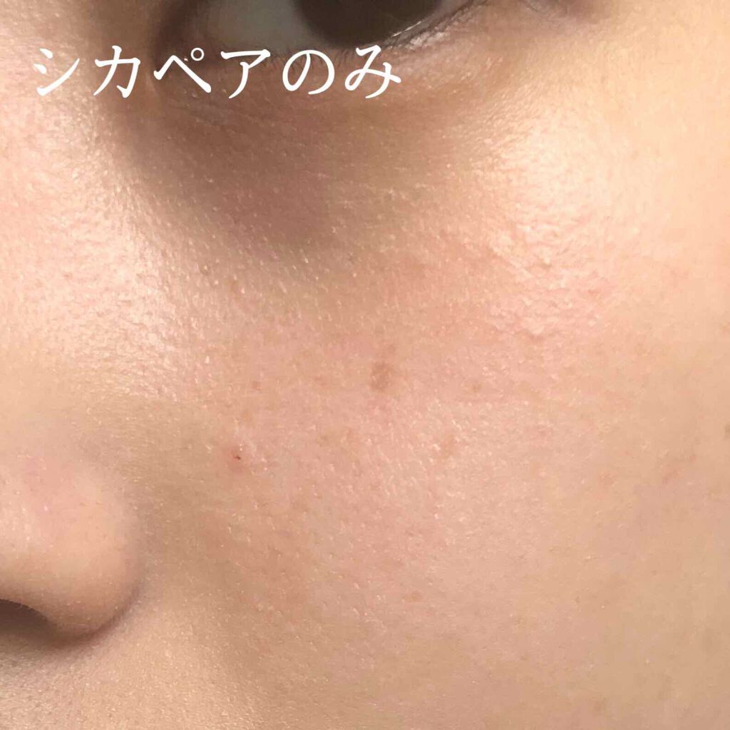 ドクタージャルト シカペア リカバー (第2世代)/Dr.Jart+/フェイスクリームを使ったクチコミ(3枚目)