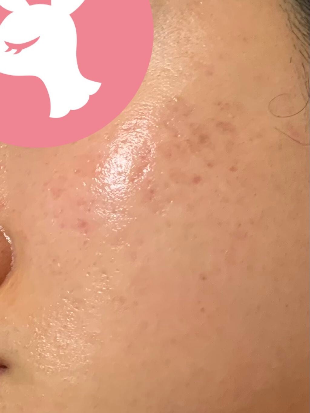 美白化粧水 VC/ちふれ/化粧水を使ったクチコミ(2枚目)