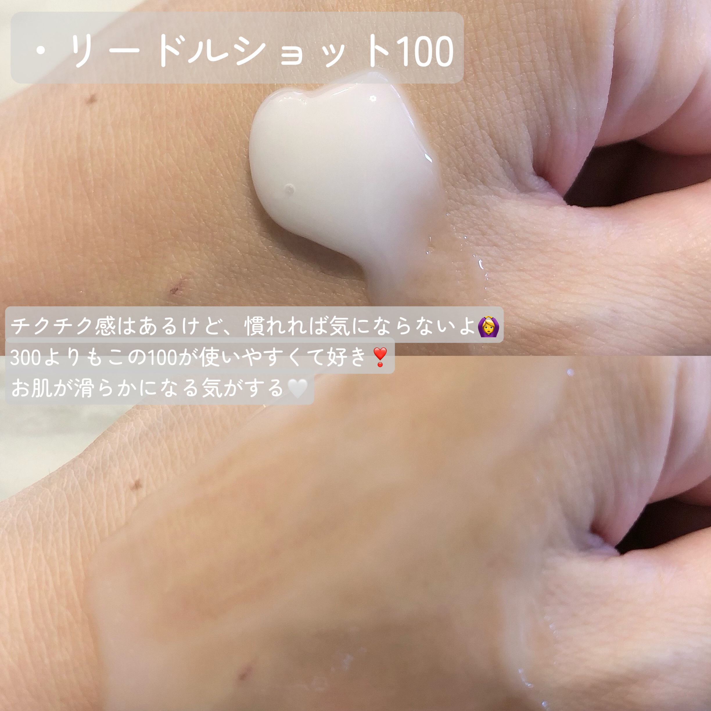 リードルショット100/VT/美容液を使ったクチコミ（3枚目）