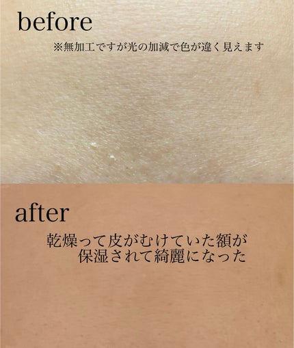 ピートピーディーアールエヌ ラッピングショット フィールオフマスク/One-day's you/シートマスク・パックを使ったクチコミ(4枚目)