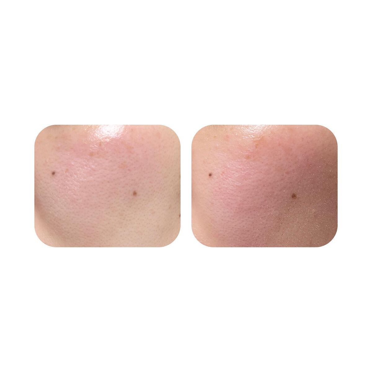 CICA マイルドアイクリーム/VT/アイケア・アイクリームを使ったクチコミ(6枚目)