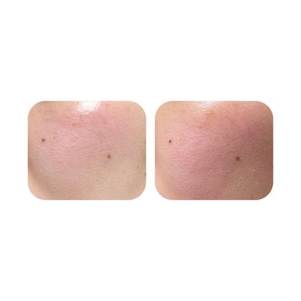 CICA マイルドアイクリーム/VT/アイケア・アイクリームを使ったクチコミ(6枚目)