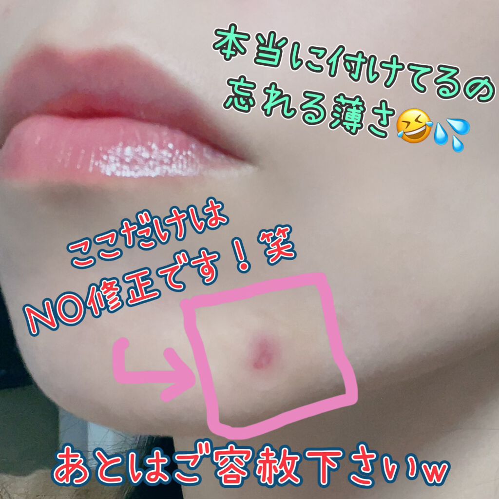 極薄透明パッチ nikipa!/金冠堂/にきびパッチを使ったクチコミ(2枚目)