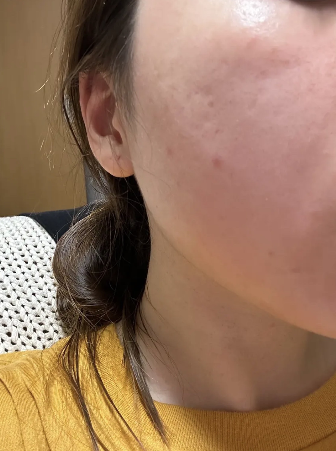 薬用しみ集中対策 プレミアム美容液/メラノCC/美容液を使ったクチコミ（1枚目）