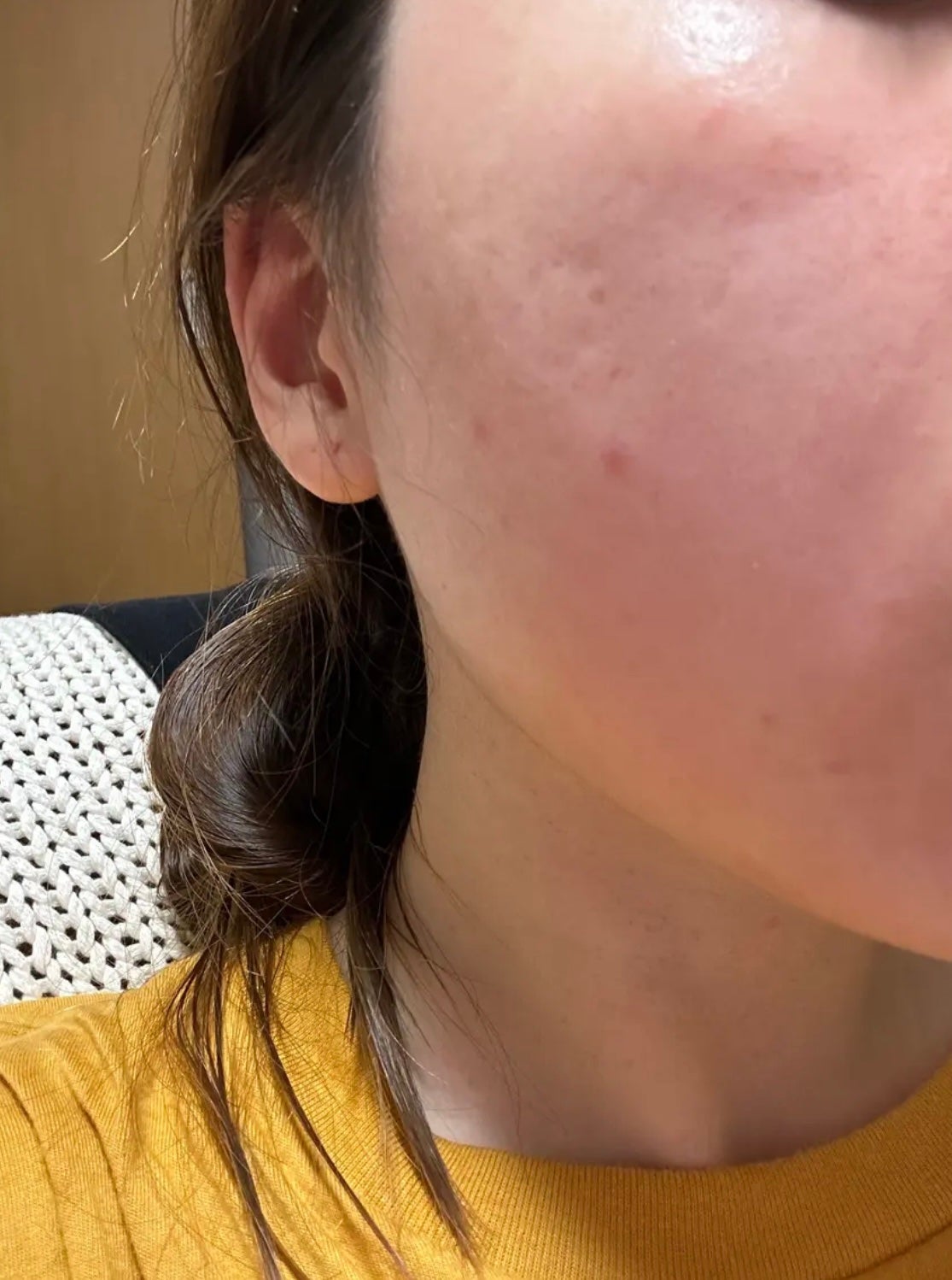 薬用しみ集中対策 プレミアム美容液/メラノCC/美容液を使ったクチコミ(1枚目)