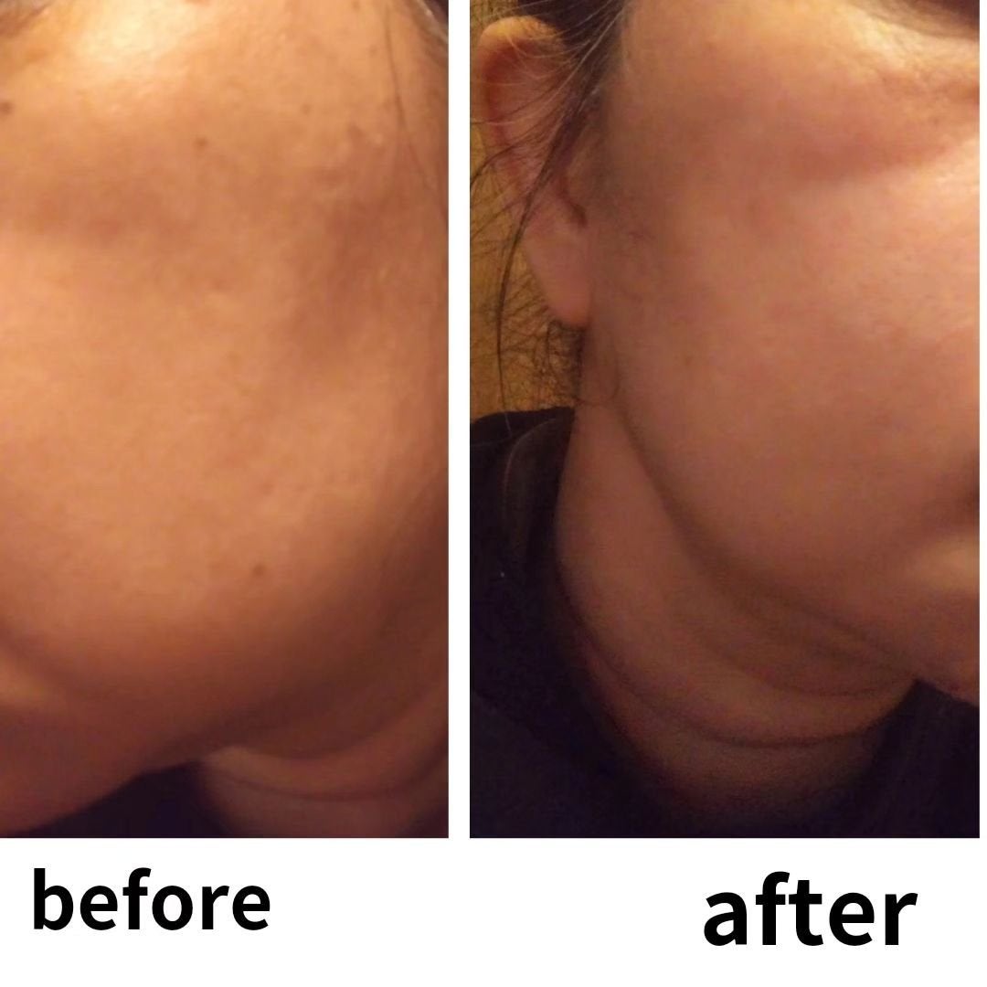 ひろりん【敏感肌、混合肌、揺らぎ肌、エイジングケア】 on LIPS 「DIACRYSTAは、かっさの様に疲れている所のケアも出来ます..」(8枚目)