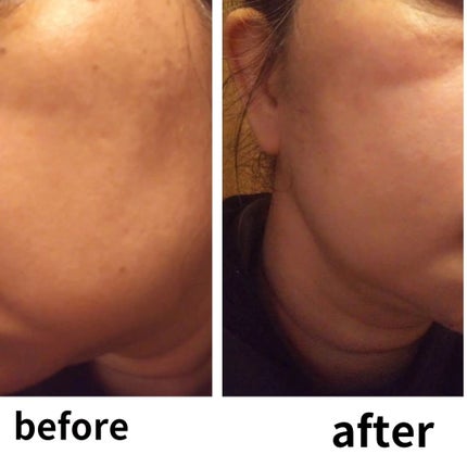 ひろりん【敏感肌、混合肌、揺らぎ肌、エイジングケア】 on LIPS 「DIACRYSTAは、かっさの様に疲れている所のケアも出来ます..」(8枚目)