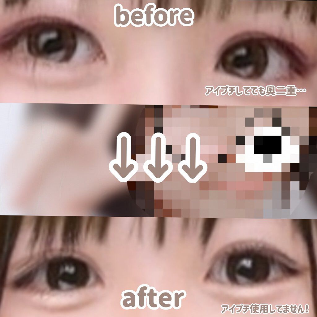 ダブルアイリッド/DAISO/二重まぶた用アイテムを使ったクチコミ（3枚目）