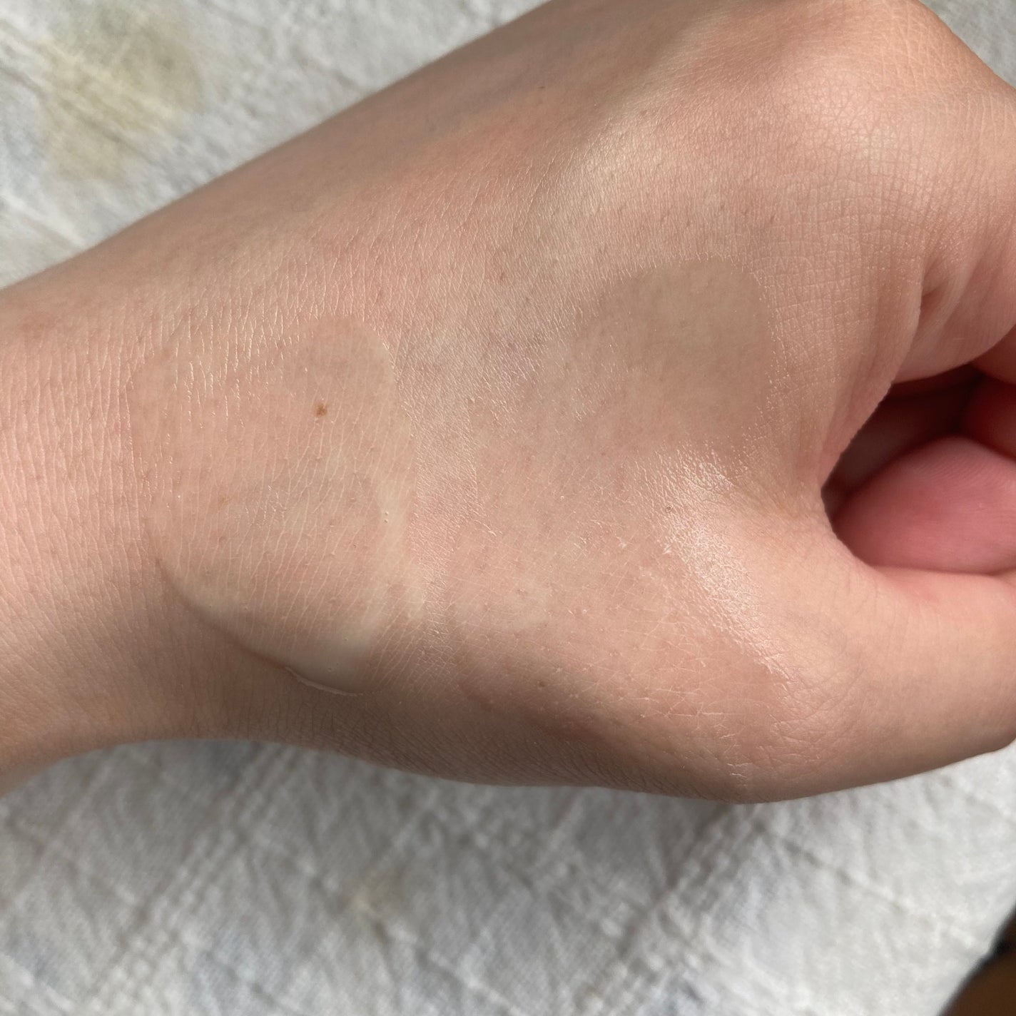 シカレチA エッセンス0.1/VT/美容液を使ったクチコミ(6枚目)