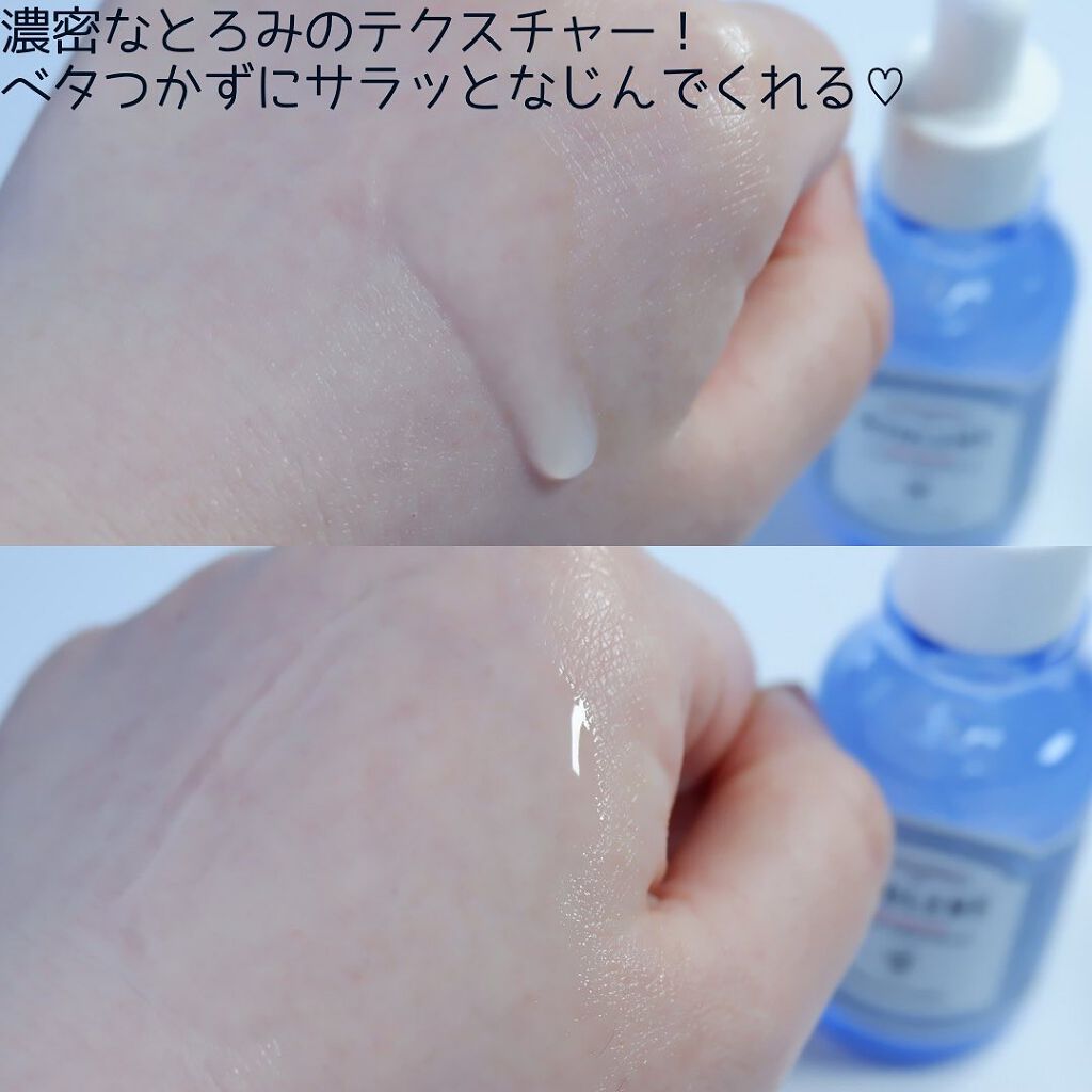 ハイポアレジェニックシカアンプル/Dermatory/美容液を使ったクチコミ(9枚目)