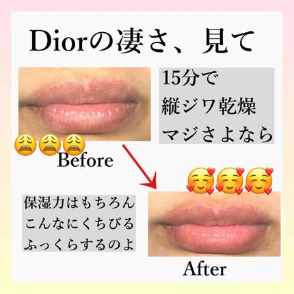 【旧】ディオール アディクト リップ マキシマイザー/Dior/リップグロスを使ったクチコミ(1枚目)