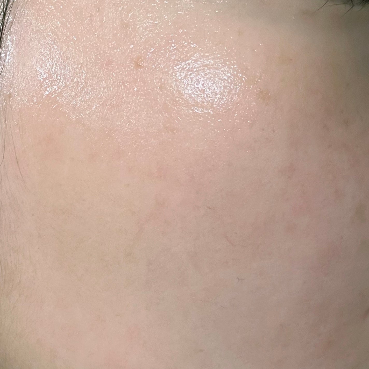 バランスVCオールインワンセラム/コルミー/オールインワン化粧品を使ったクチコミ(4枚目)