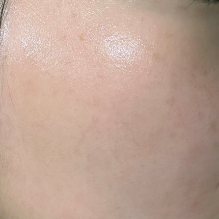 バランスVCオールインワンセラム/コルミー/オールインワン化粧品を使ったクチコミ(4枚目)