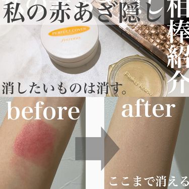 カバーリングファンデーション かづきれいこを使った口コミ 今回紹介するのは私の左頬にある赤あざ隠しメ By ふたば 混合肌 代後半 Lips