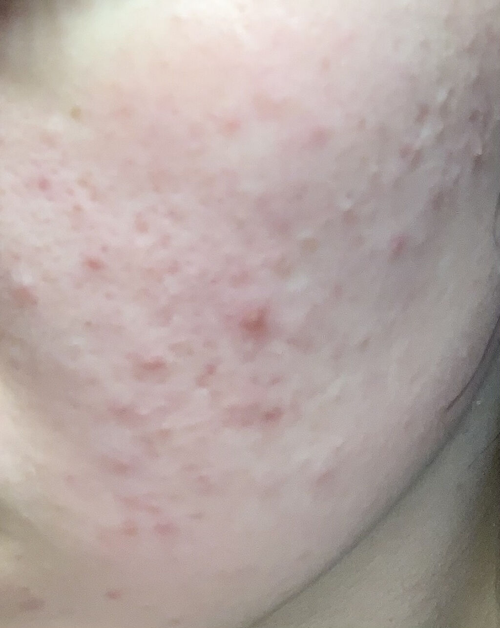 DHC ビタミンＣハードカプセル/DHC/美容サプリメントを使ったクチコミ（1枚目）