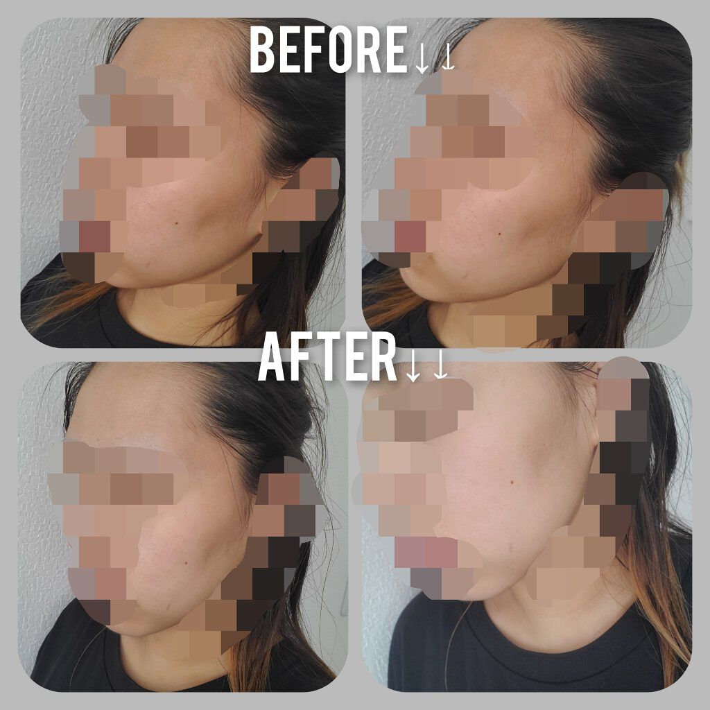 パーフェクトホワイトクレイ/SENKA（専科）/洗顔フォームを使ったクチコミ（3枚目）