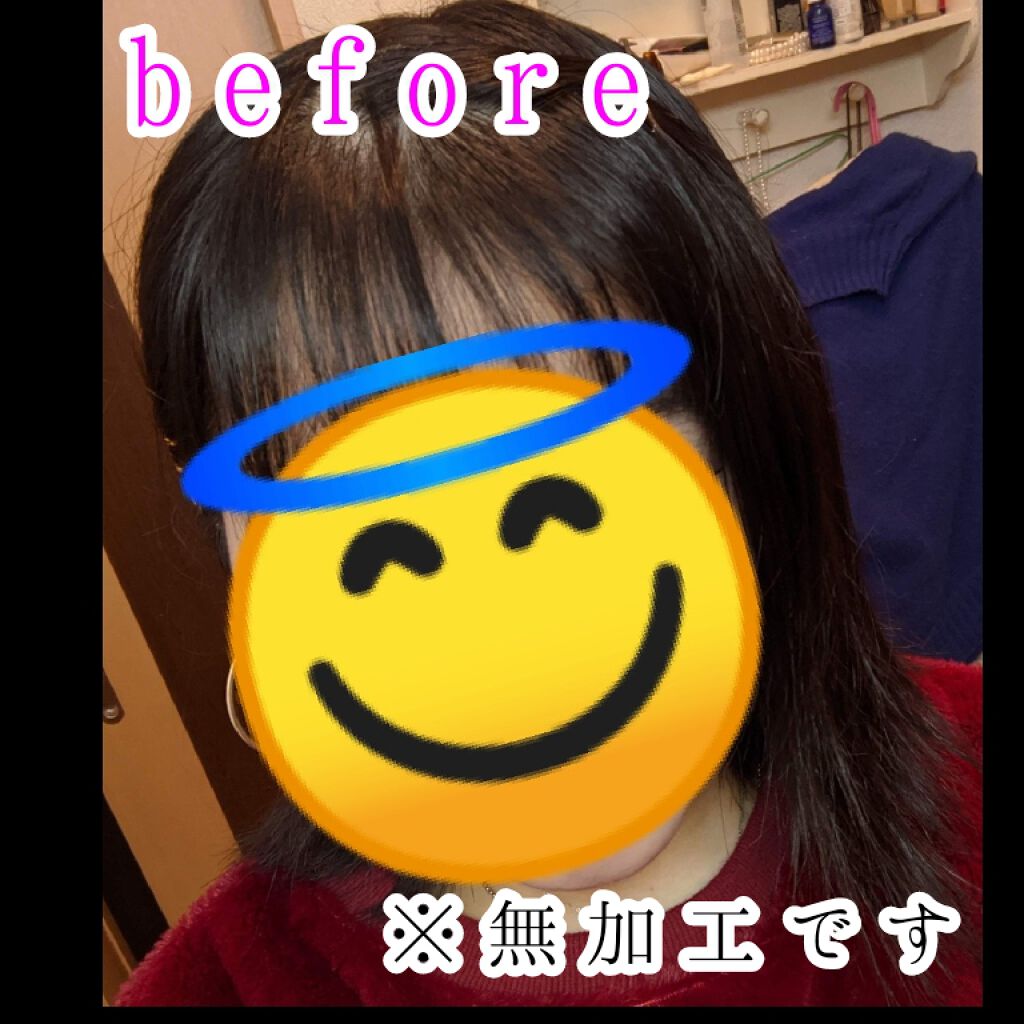 オキシドール(医薬品)/日本薬局方/その他を使ったクチコミ(2枚目)