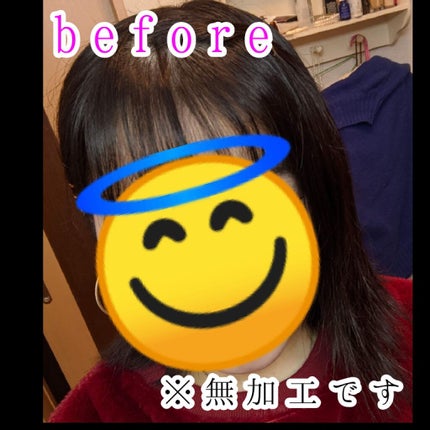 オキシドール(医薬品)/日本薬局方/その他を使ったクチコミ(2枚目)