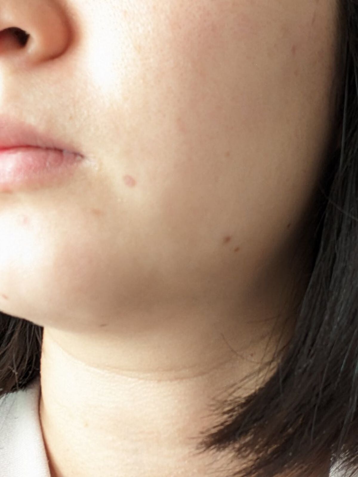 pinky on LIPS 「リベンジ1ヶ月経過しました!✼••┈┈••✼••┈┈••✼••..」(2枚目)