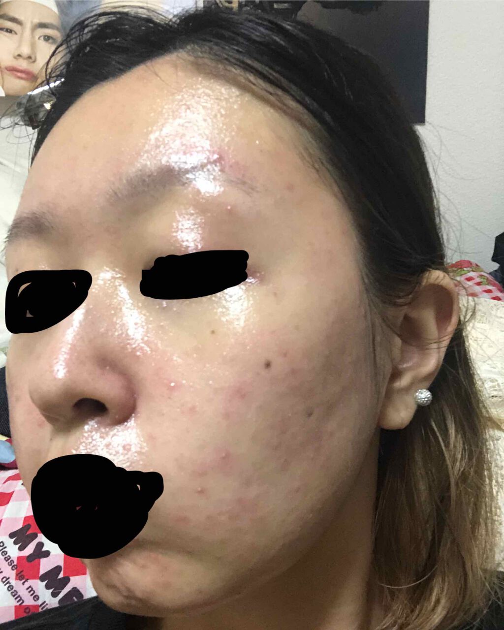 AC フェイスローション/NOV/化粧水を使ったクチコミ（3枚目）