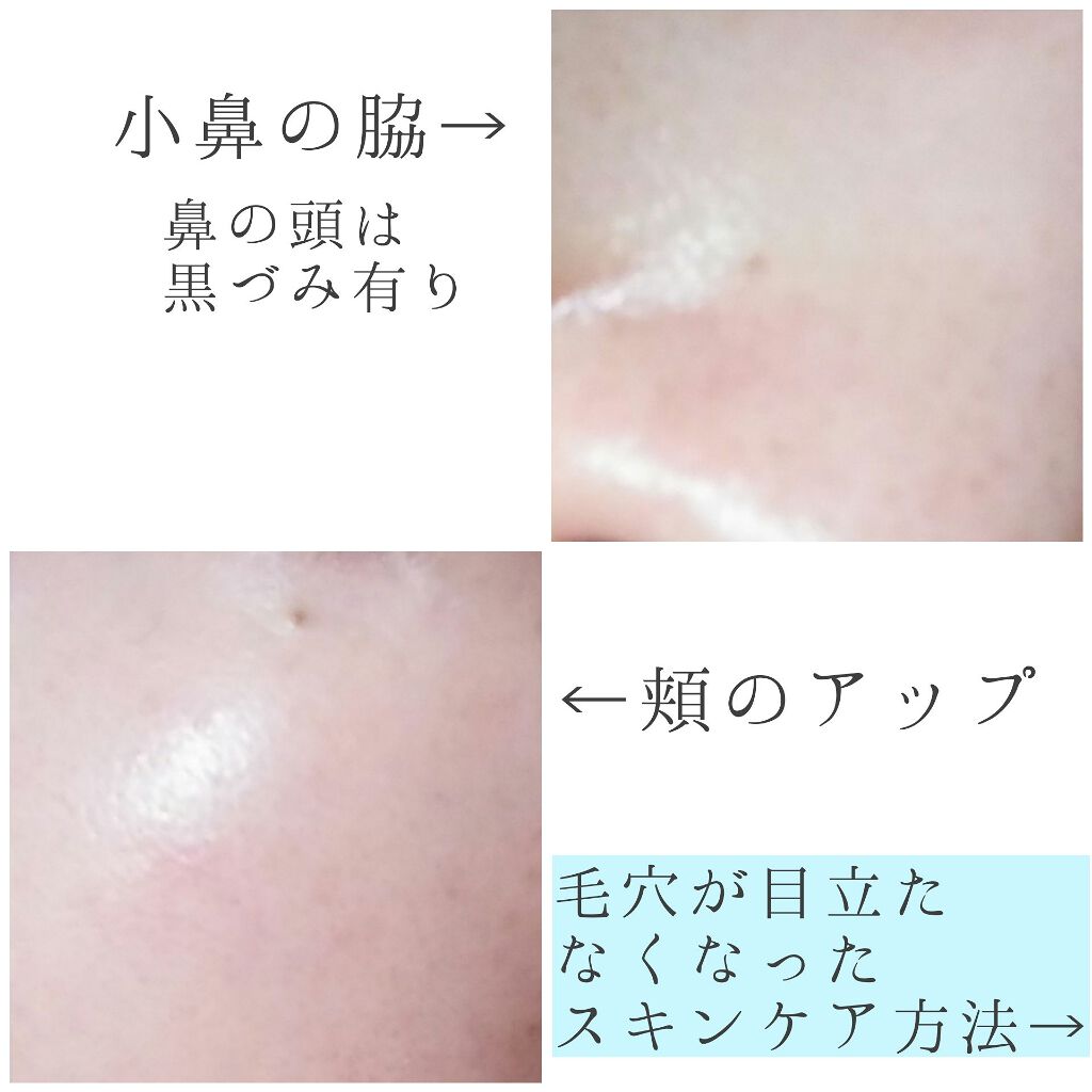 ジョンソン ベビーオイル 無香料/ジョンソンベビー/ボディオイルを使ったクチコミ(2枚目)