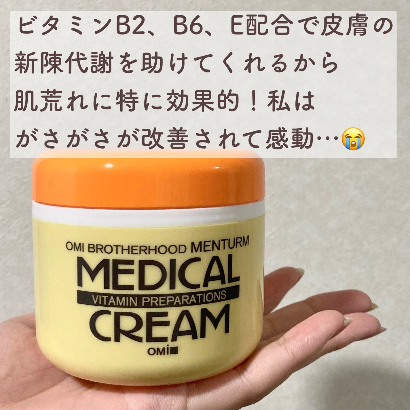 メディカルクリームG(薬用クリームG)/メンターム/ハンドクリームを使ったクチコミ(2枚目)