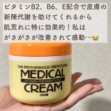 メディカルクリームG（薬用クリームG） 145g/メンターム/ハンドクリームの画像