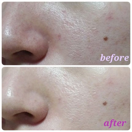 くずれにくい うるおい質感 メルティリキッドファンデーション/プリマヴィスタ/リキッドファンデーションを使ったクチコミ(3枚目)