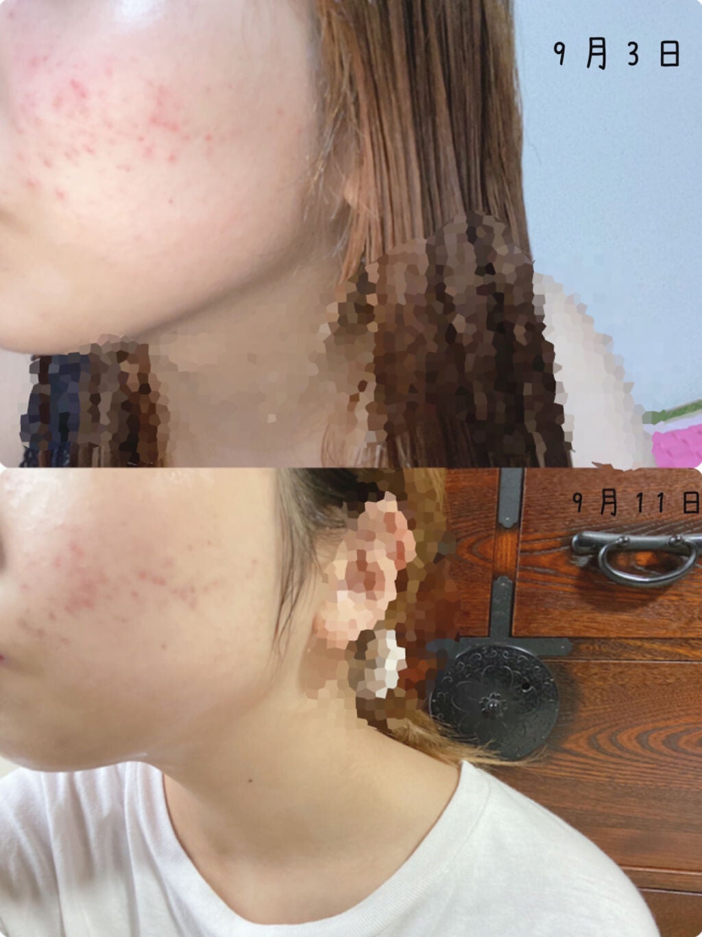 ハトムギ化粧水(ナチュリエ スキンコンディショナー R )/ナチュリエ/化粧水を使ったクチコミ(1枚目)