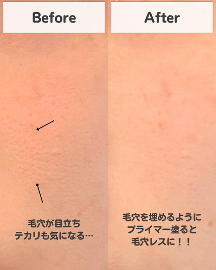 つむオンニ🍊フォロバ on LIPS 「見返したいと思ったら、今すぐ保存🍊化粧しても毛穴が気になる....」(4枚目)