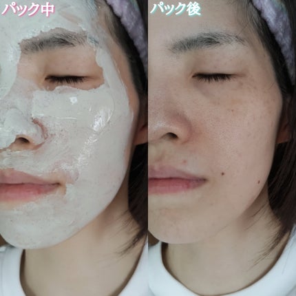 グリーンマスク/Torhop/洗い流すパック・マスクを使ったクチコミ(6枚目)