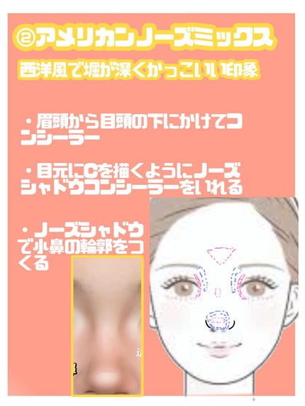 ディオールスキン フォーエヴァー スキン コレクト コンシーラー/Dior/リキッドコンシーラーを使ったクチコミ(3枚目)